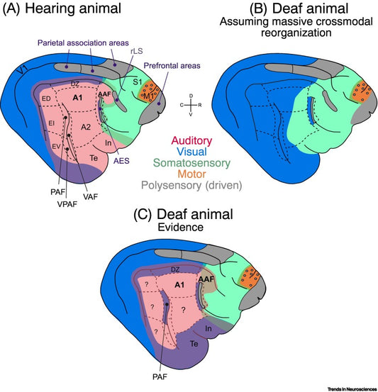 難聴におけるクロスモーダル可塑性