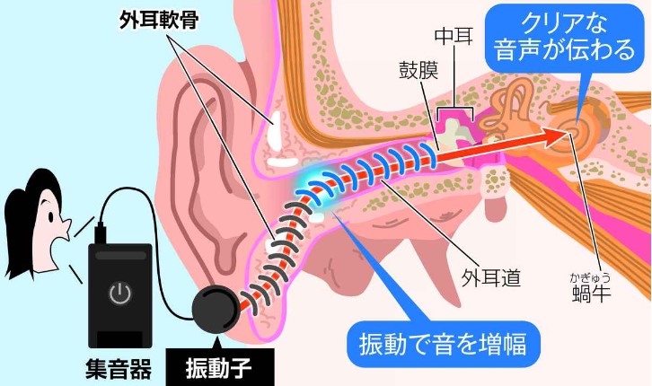 軟骨伝導イヤホン　各地で導入広がる　聴力低下でも音声がクリアに