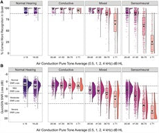 難聴の程度および種類と、静寂および騒音下での音声認識との関係に関する大規模研究