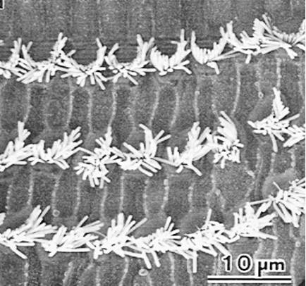 人間の蝸牛有毛細胞の再生はどのくらい近づいているのでしょうか?