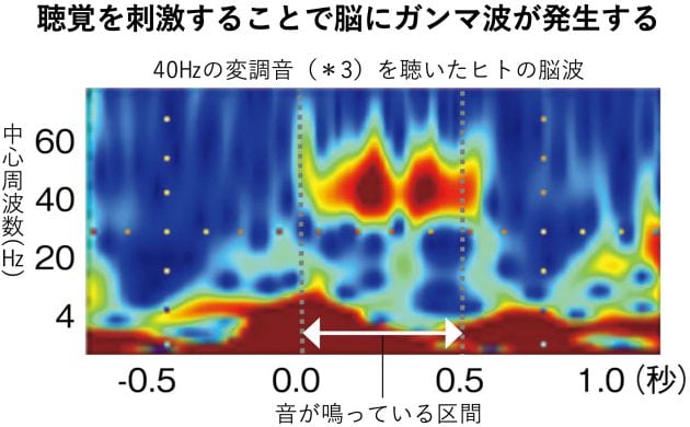 最新研究！ 〝聴くこと〟で脳を刺激して、認知機能をキープする。